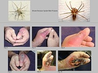 ARANHA MARROM